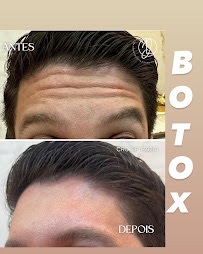 Dra. Jaqueline Lima Botox Facial