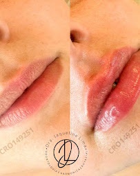 Dra. Jaqueline Lima Procedimento Boca