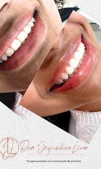 Dra. Jaqueline Lima Tratamento Sorriso