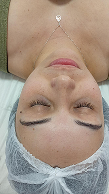 Limpeza de Pele da Ellen Penedo Esteticista Facial