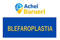 Blefaroplastia em Barueri