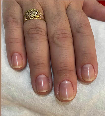 Unha Antes Toque da Beleza